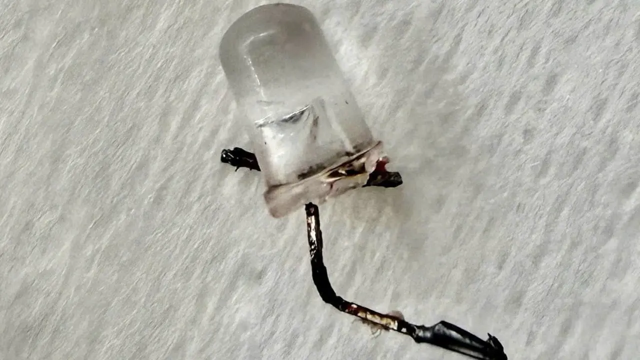 Bác sĩ xoay từng mm gắp bóng đèn LED khỏi phổi bé gái