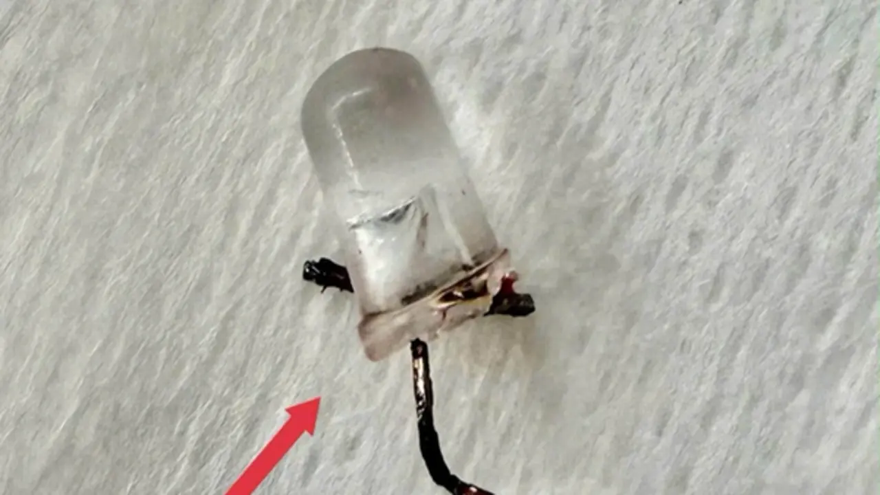 Bé 9 tháng tuổi ho nhiều ngày, bố mẹ "sốc" khi bác sĩ gắp ra đèn LED nằm trong phế quản