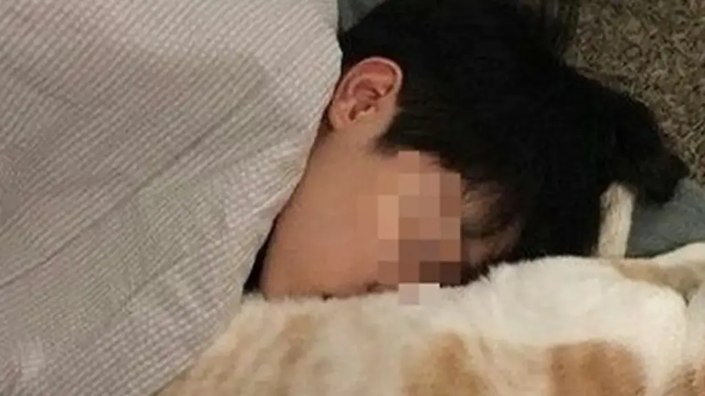Ôm mèo mà không rửa tay, cậu bé 14 tuổi "sốc" khi biết mình "gần như mù lòa"