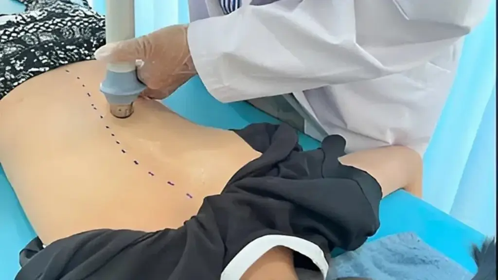 Vẹo cột sống vì tật 'chân thấp chân cao'
