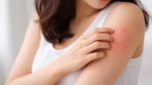5 thay đổi trên cơ thể cảnh báo thận hoạt động kém