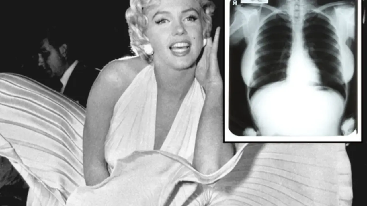 Ảnh X-quang của Marilyn Monroe gây phẫn nộ khi bị đấu giá
