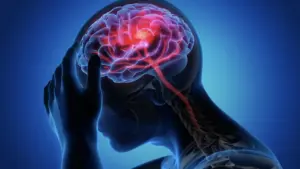 Bác sĩ Mỹ chỉ ra 7 thói quen nên tránh để ngừa đột quỵ