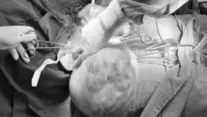 Bé gái 14 tuổi bụng to bất thường, bố mẹ sốc khi bác sĩ phát hiện bí mật "đáng sợ" bên trong