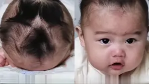 Bé trai có 9 xoáy tóc hiếm gặp