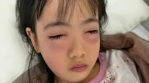 Chơi bong bóng xà phòng, bé 5 tuổi nguy kịch phải cấp cứu, sự thật khiến mẹ "sốc nặng"