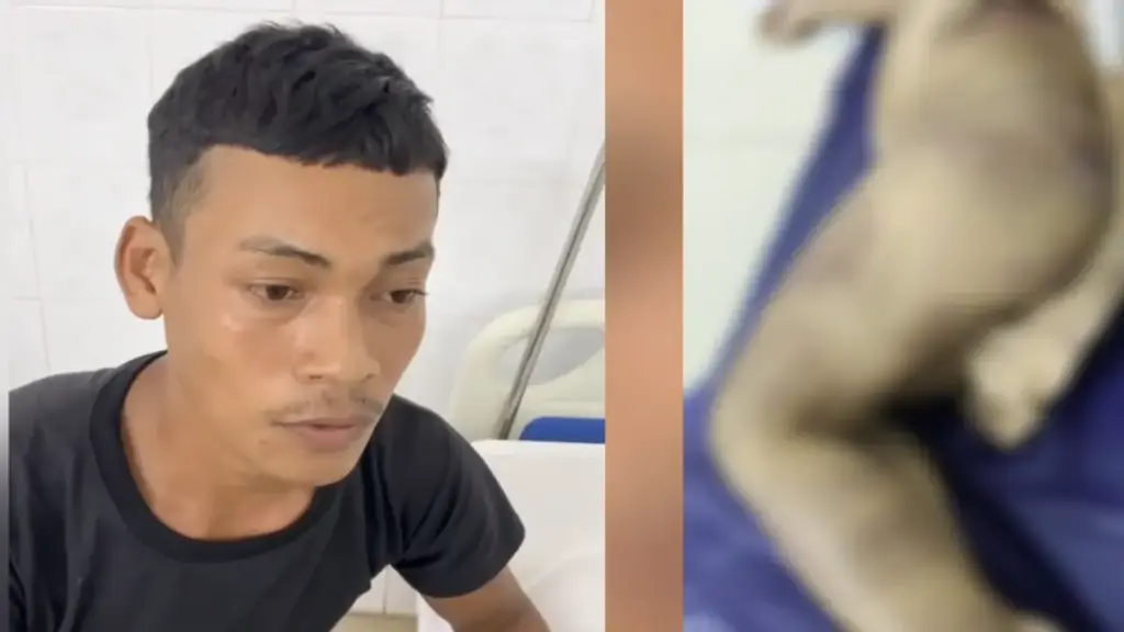 Khởi tố mẹ ruột và 'cha dượng' bạo hành khiến bé trai 2 tuổi nguy kịch