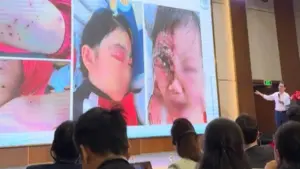 Không nên xem nhẹ thủy đậu, bác sĩ cảnh báo biến chứng nguy hiểm