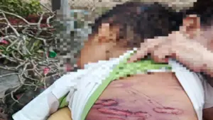 Mẹ và 'cha hờ' bị bắt vì nhiều lần đánh con 2 tuổi đa chấn thương