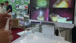 Mỗi người dân sẽ được khám bệnh răng miệng ít nhất 1 lần/năm