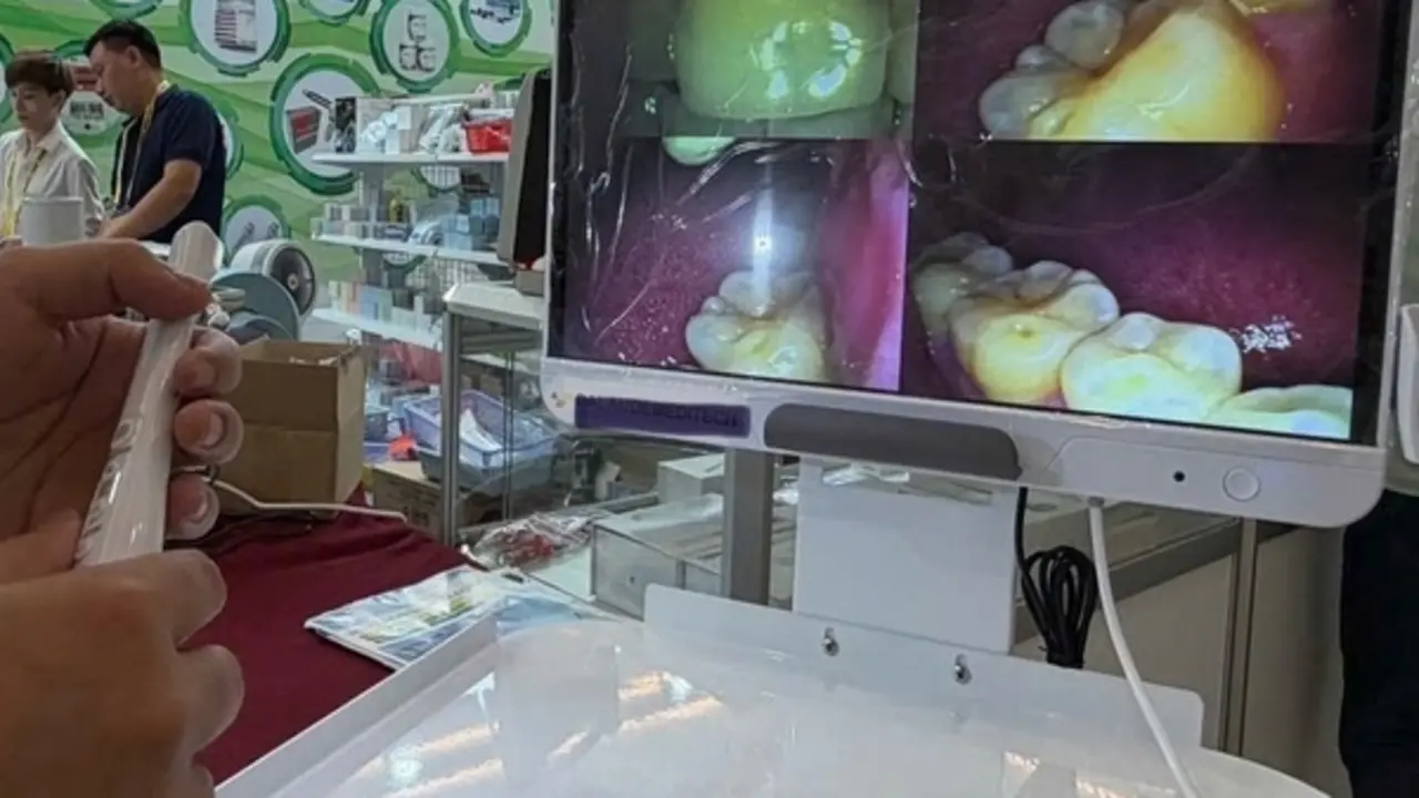 Mỗi người dân sẽ được khám bệnh răng miệng ít nhất 1 lần/năm