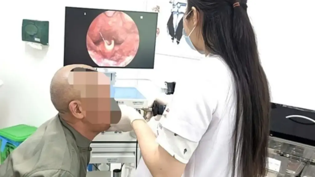 Nhai đá sau vận động, người đàn ông 66 tuổi suýt mất mạng chỉ vì sai lầm này
