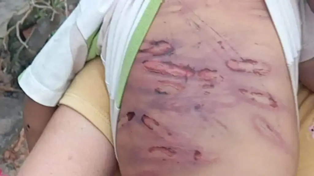 Tạm giữ mẹ ruột và người tình hành hạ bé trai 2 tuổi hôn mê, gãy xương
